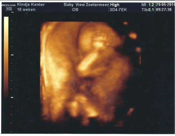pretecho-mamablogger-persoonlijk-geslachtsbepaling-