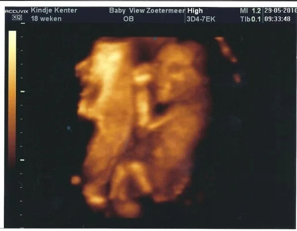 pretecho-mamablogger-persoonlijk-geslachtsbepaling-