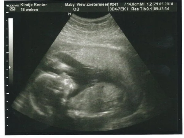 pretecho-mamablogger-persoonlijk-geslachtsbepaling-