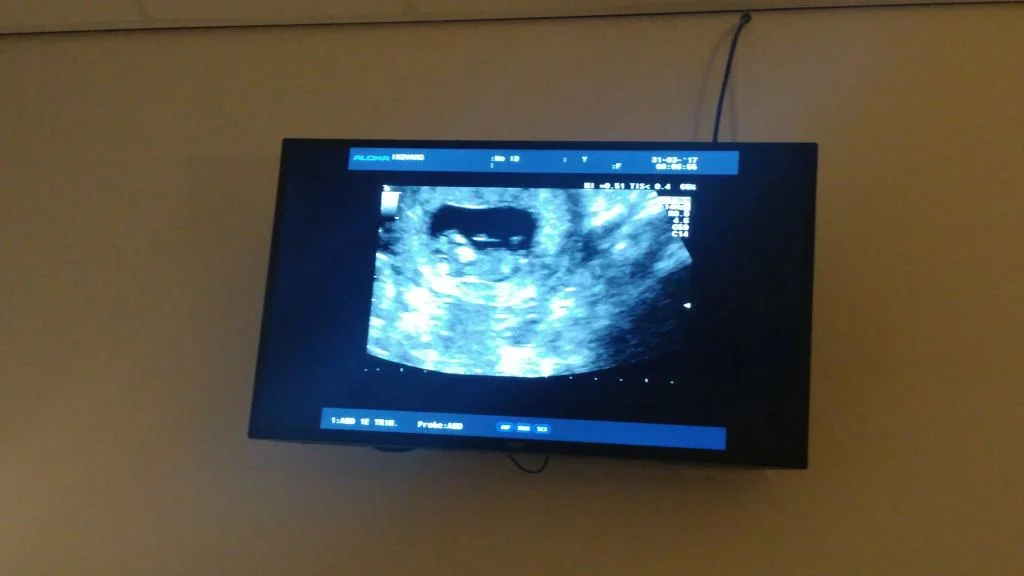 zwangerschapsupdate_zwanger_mamablogger_gezin_echo_termijnecho_marisca_