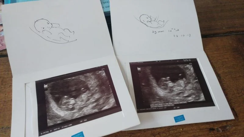 zwangerschapsupdate_zwanger_mamablogger_gezin_echo_termijnecho_marisca_