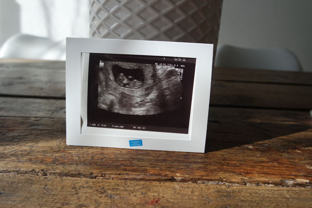 Zwangerschapsupdate #2 | Week 10, tijd voor een echo!