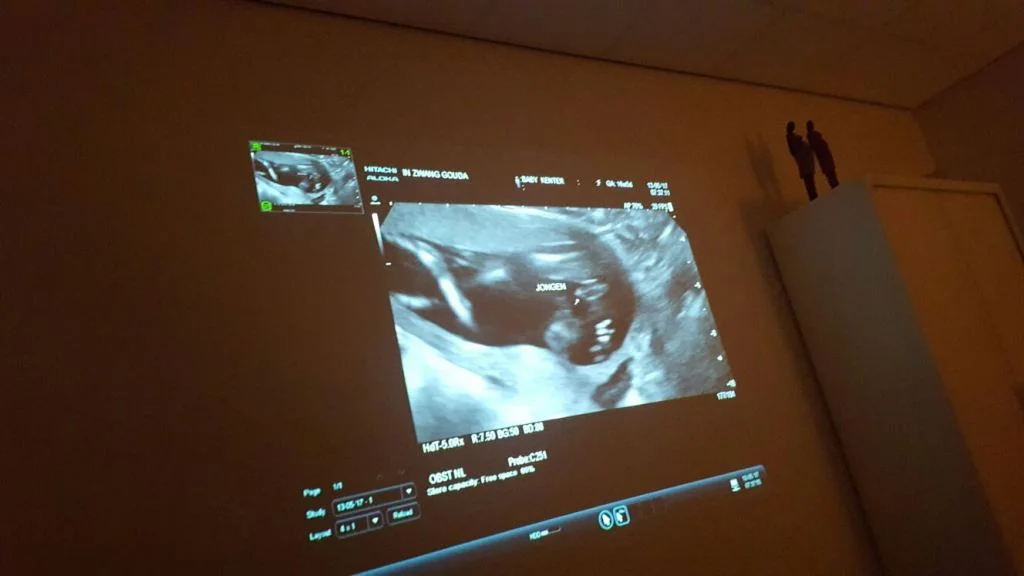 zwangerschapsupdate_echo_geslacht_jongetje_mamablogger_