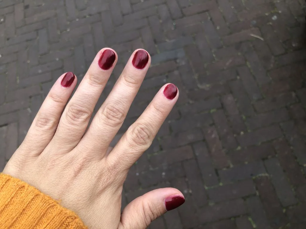 diary_mamablogger_singelloop_persoonlijk_nagels_9-jaar prik_