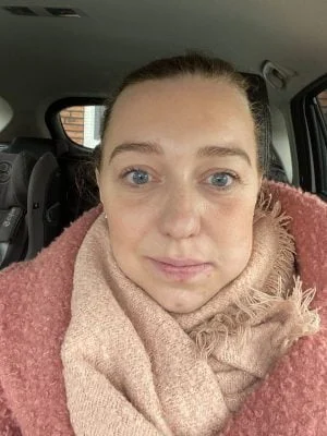 verstandskies_tanden_tandarts_mamablogger_