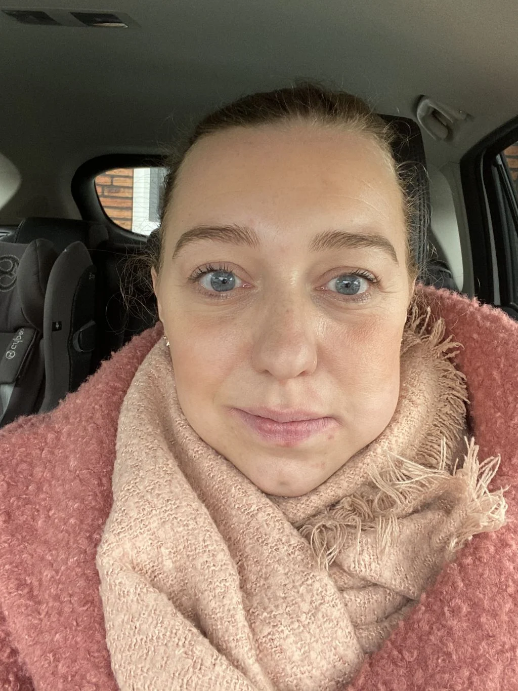 verstandskies_tanden_tandarts_mamablogger_
