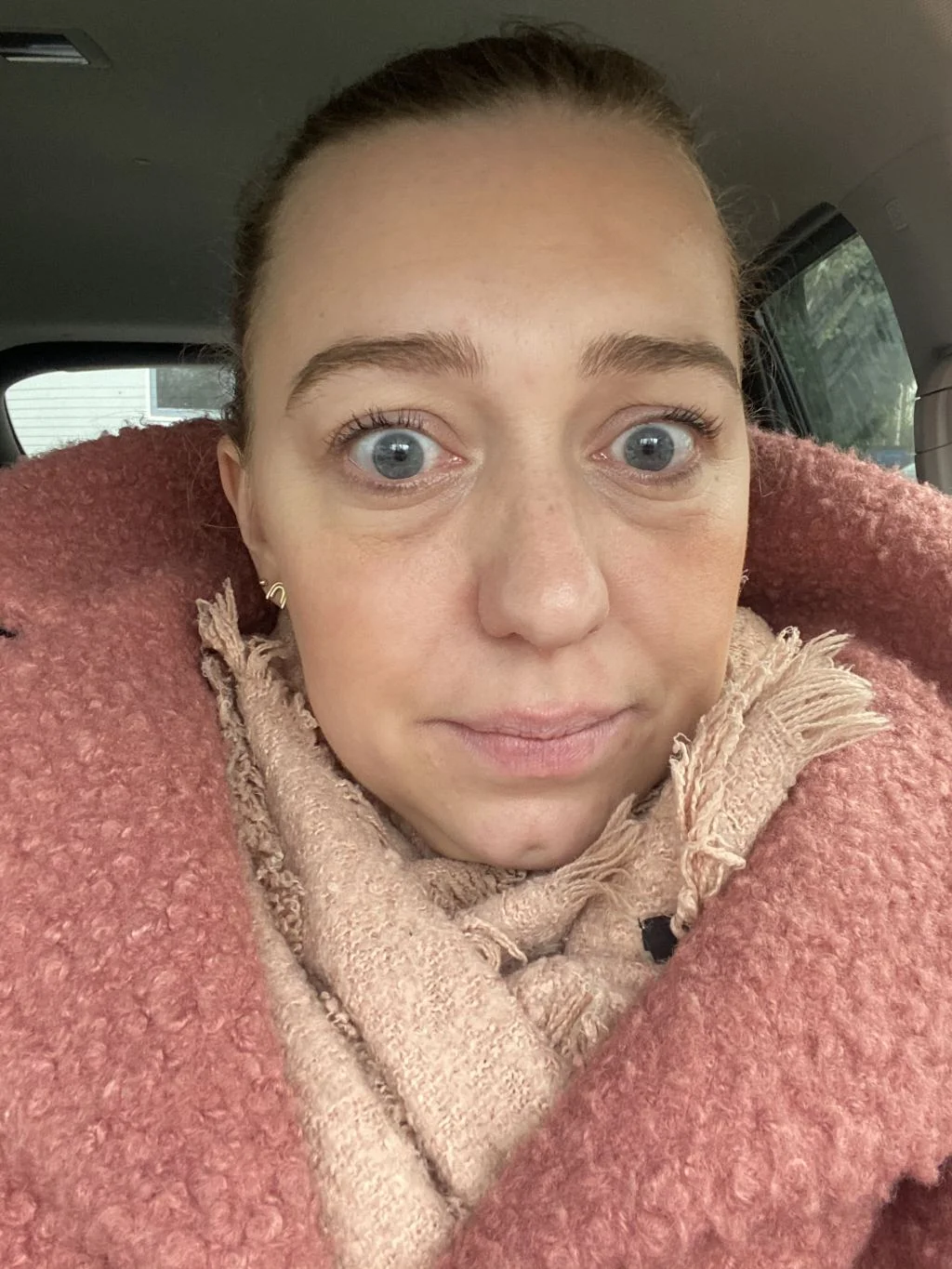verstandskies_tanden_tandarts_mamablogger_