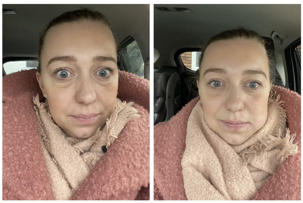 verstandskies_tanden_tandarts_mamablogger_