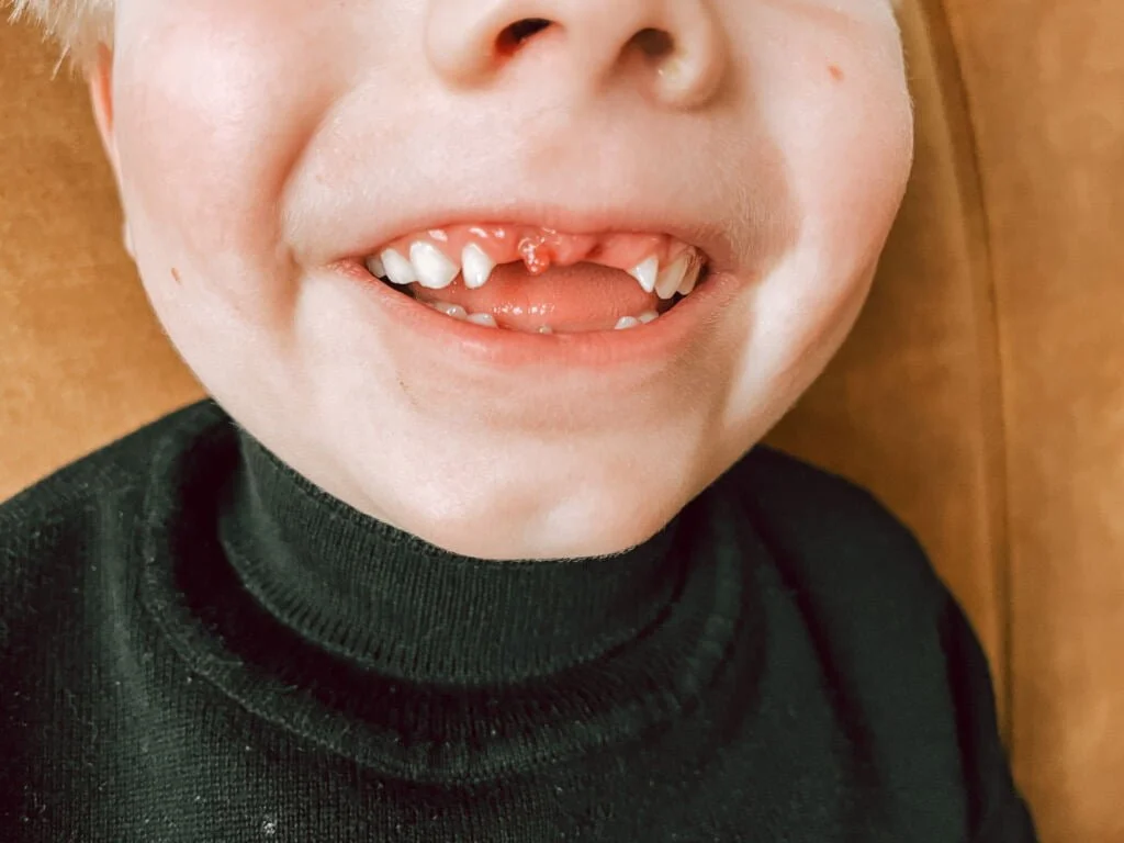 diary_persoonlijk_mamablogger_doorpas_tanden wisselen_volle week_