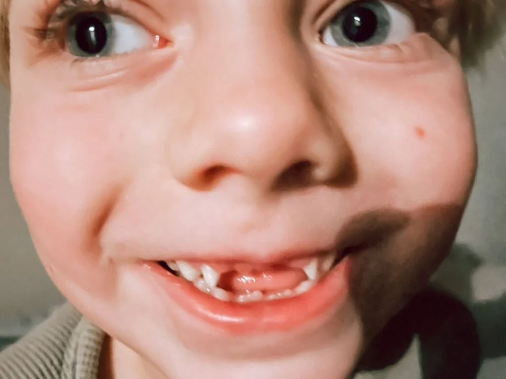 diary_persoonlijk_mamablogger_doorpas_tanden wisselen_volle week_